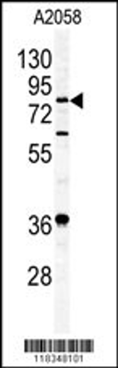 Western blot analysis of APEH antibody in A2058 cell line lysates (35ug/lane)