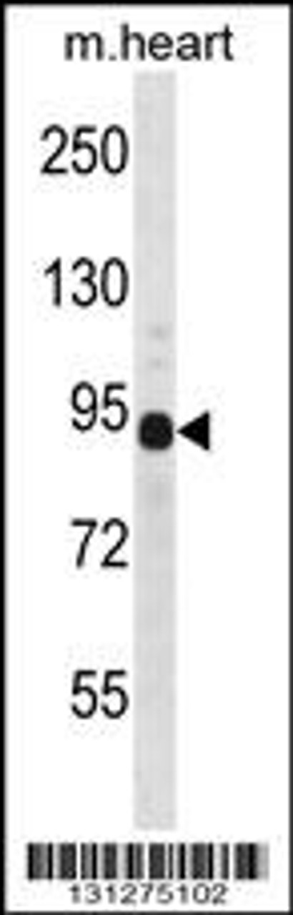 Western blot analysis in mouse heart tissue lysates (35ug/lane) .