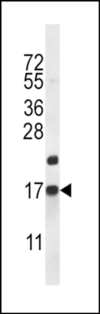 Western blot analysis in mouse heart tissue lysates (35ug/lane) .