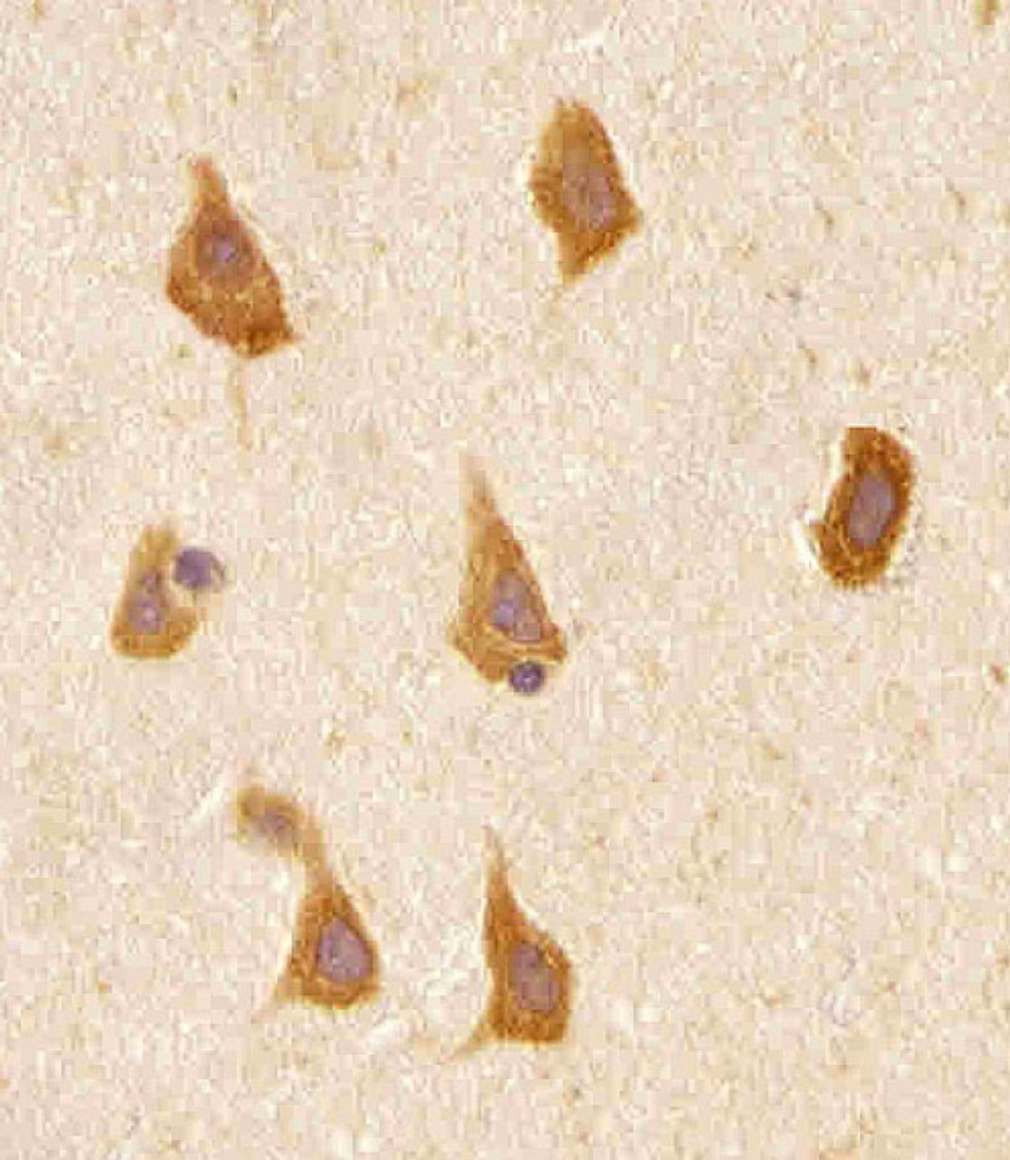 Antibody staining PREX1 in human brain tissue sections by Immunohistochemistry (IHC-P - paraformaldehyde-fixed, paraffin-embedded sections) .