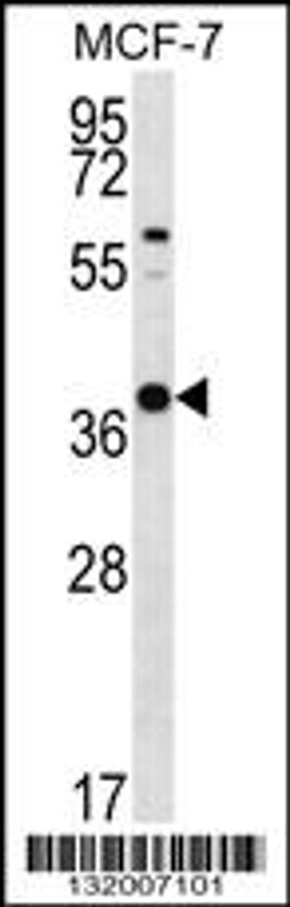 Western blot analysis in MCF-7 cell line lysates (35ug/lane) .