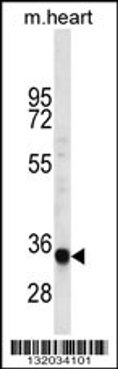 Western blot analysis in mouse heart tissue lysates (35ug/lane) .