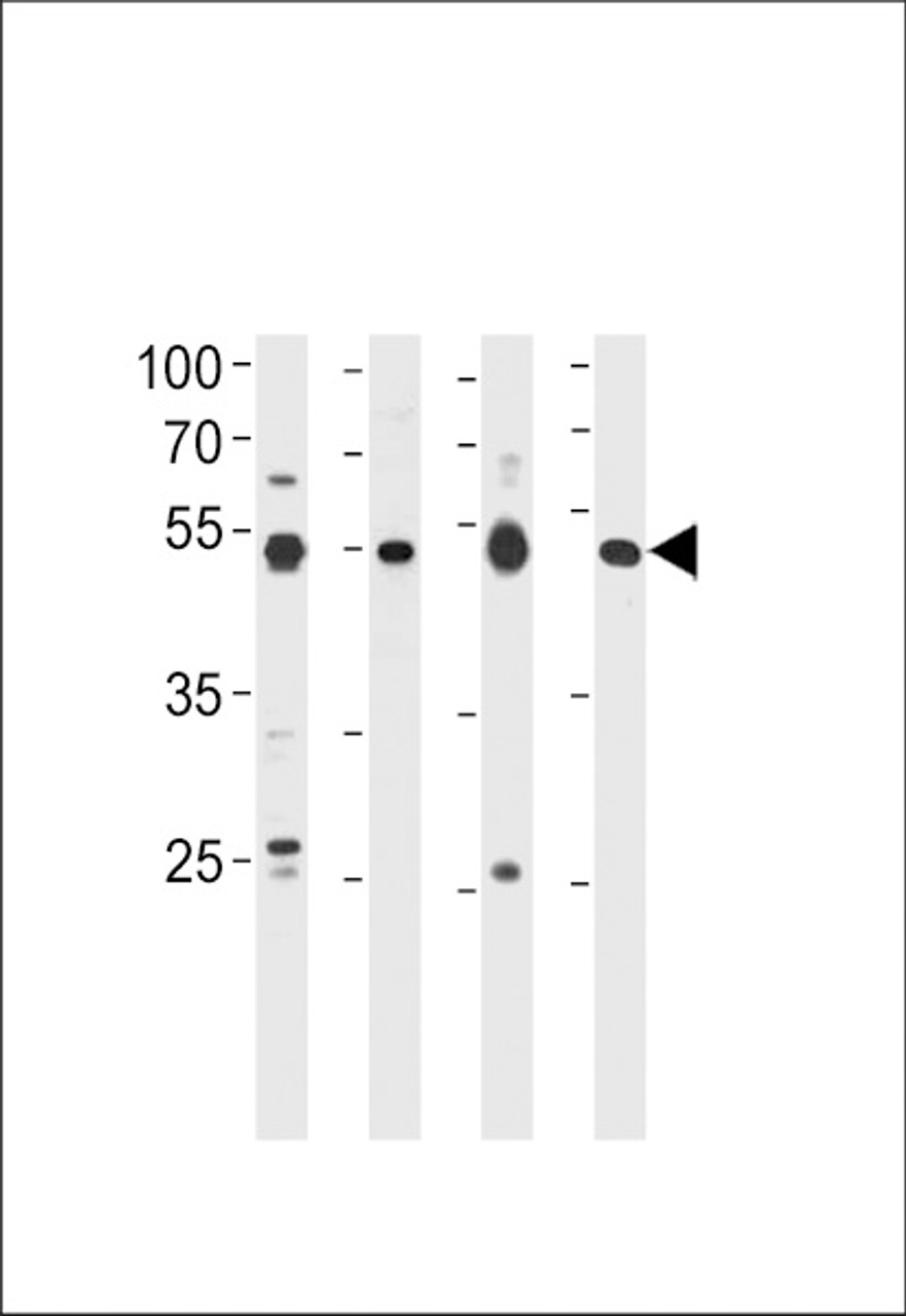 Western blot analysis in 293 cell line, human placenta, mouse brain and spleen tissue lysates (35ug/lane) .