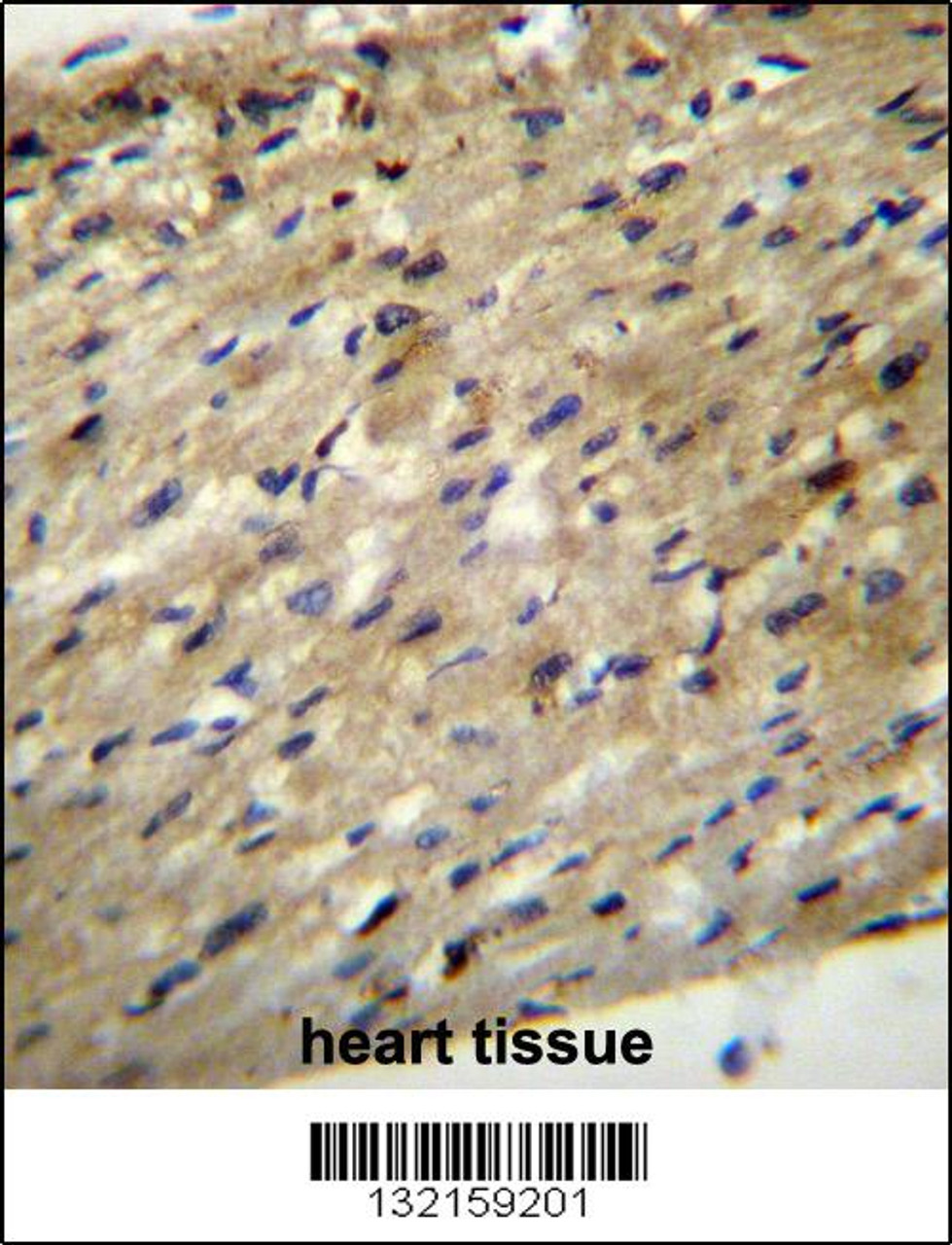 ABCD2 Antibody immunohistochemistry analysis in formalin fixed and paraffin embedded human heart tissue followed by peroxidase conjugation of the secondary antibody and DAB staining.