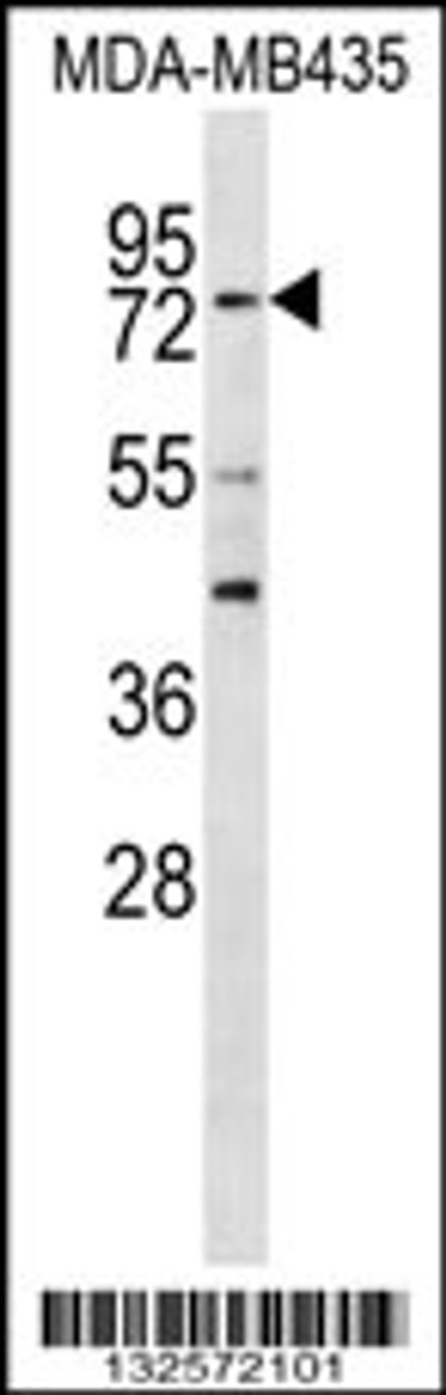 Western blot analysis in MDA-MB435 cell line lysates (35ug/lane) .