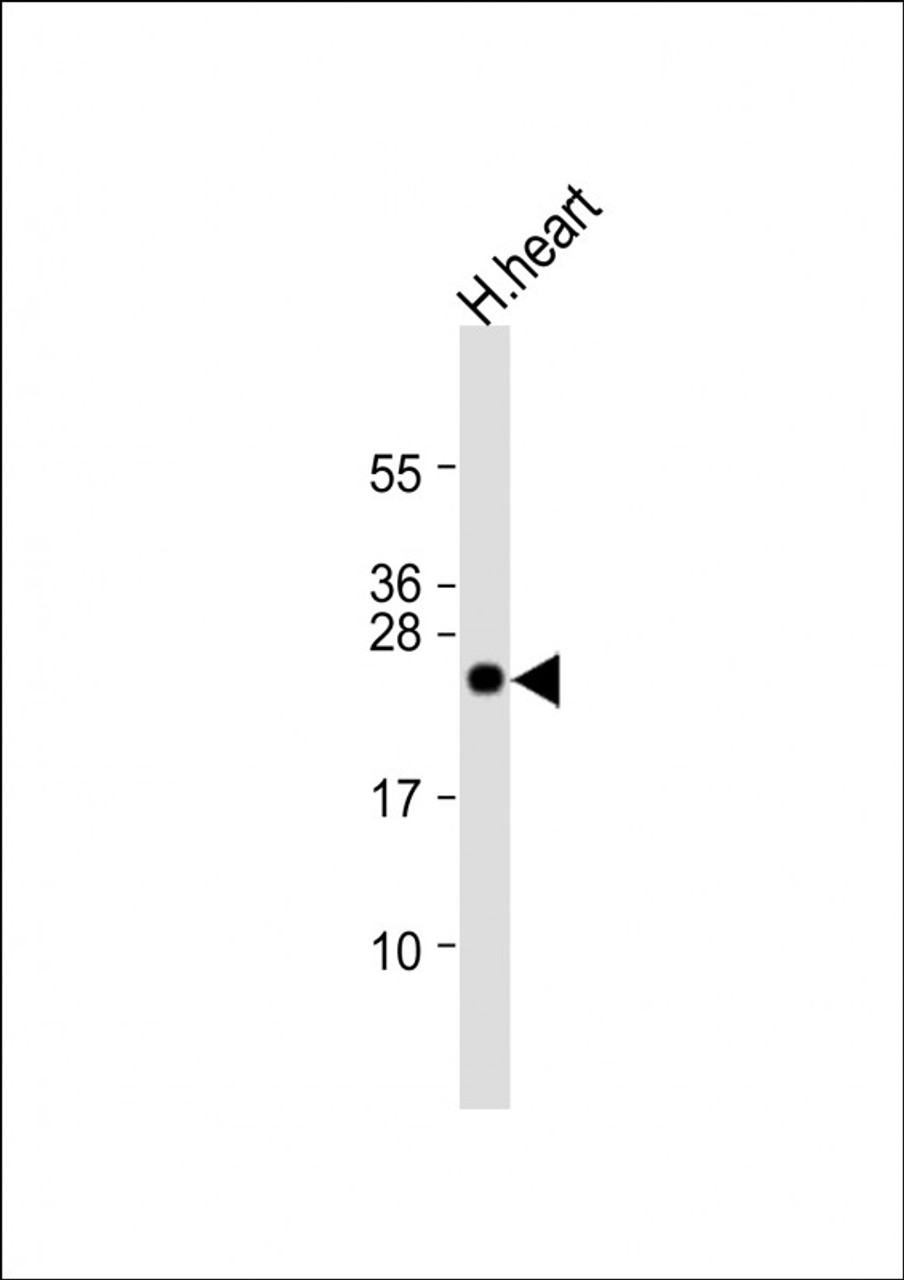 Western Blot at 1:1000 dilution + human heart lysate Lysates/proteins at 20 ug per lane.