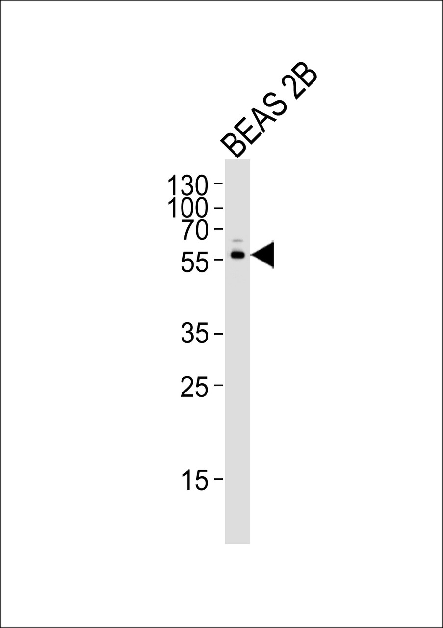 Western blot analysis of lysate from BEAS 2B cell line, using CYP2S1 Antibody at 1:1000.