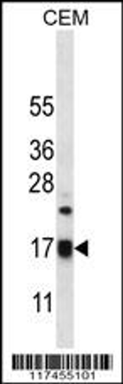 Western blot analysis in CEM cell line lysates (35ug/lane) .This demonstrates the MRPS12 antibody detected the MRPS12 protein (arrow) .