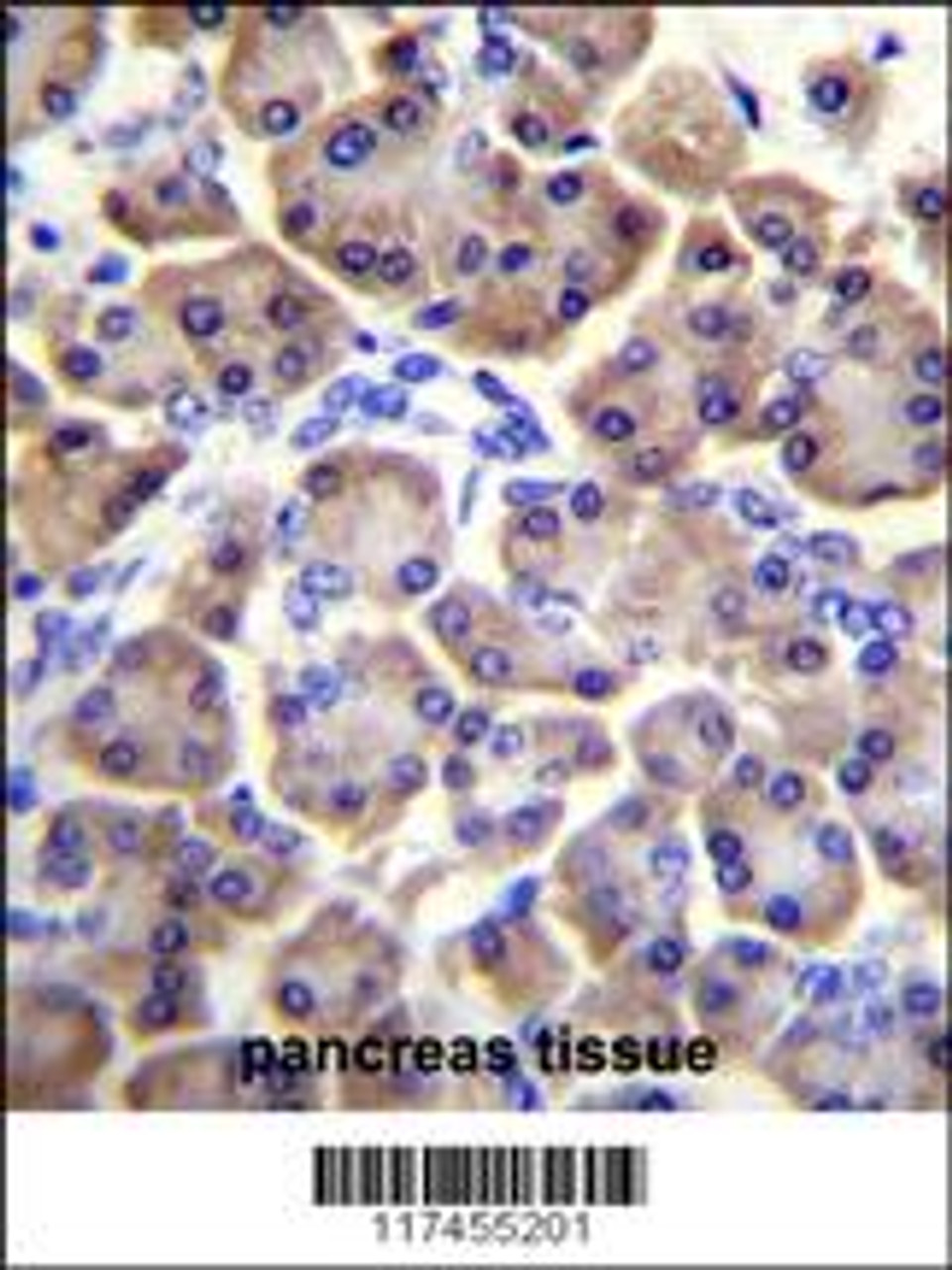 MRPS12 Antibody (Center K43) immunohistochemistry analysis in formalin fixed and paraffin embedded human pancreas tissue followed by peroxidase conjugation of the secondary antibody and DAB staining.This data demonstrates the use of MRPS12 Antibody (Center K43) for immunohistochemistry.