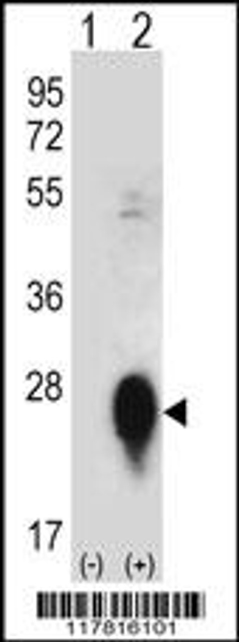 Western blot analysis of CLEC3B using rabbit polyclonal CLEC3B Antibody using 293 cell lysates (2 ug/lane) either nontransfected (Lane 1) or transiently transfected (Lane 2) with the CLEC3B gene.