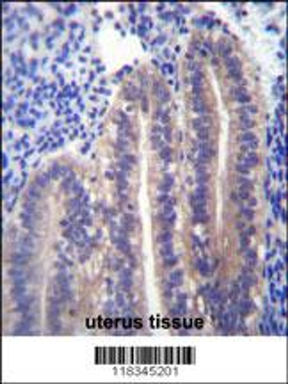 ANGPTL7 Antibody immunohistochemistry analysis in formalin fixed and paraffin embedded human uterus tissue followed by peroxidase conjugation of the secondary antibody and DAB staining.