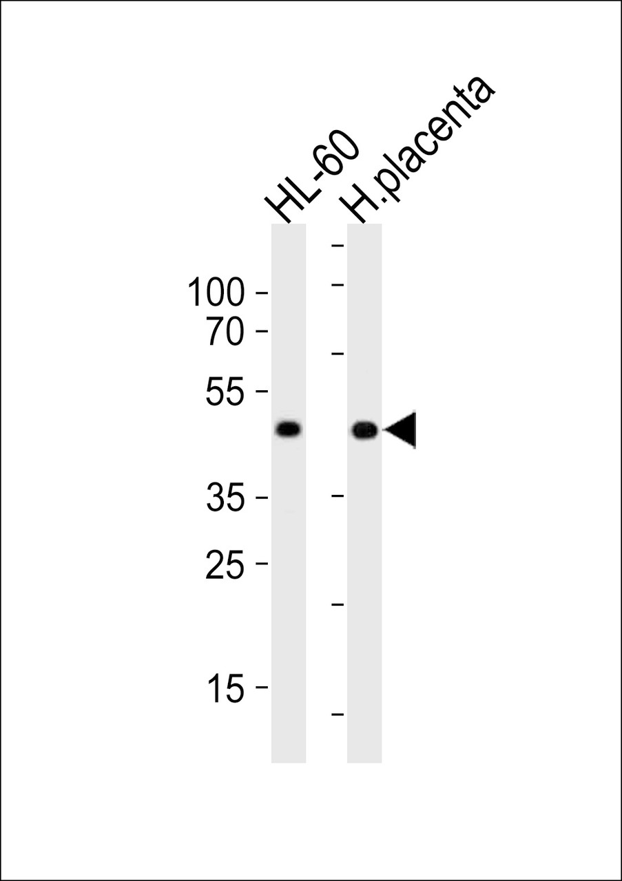 Western blot analysis in Hela cell line and human placenta tissue lysates (35ug/lane) .