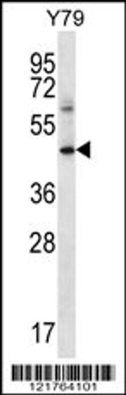 Western blot analysis in Y79 cell line lysates (35ug/lane) .