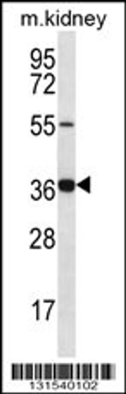 Western blot analysis in mouse kidney tissue lysates (35ug/lane) .