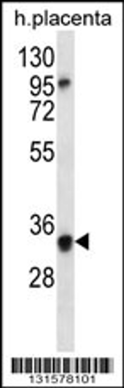 Western blot analysis in human placenta tissue lysates (35ug/lane) .