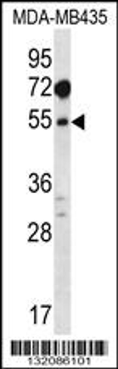 Western blot analysis in MDA-MB435 cell line lysates (35ug/lane) .