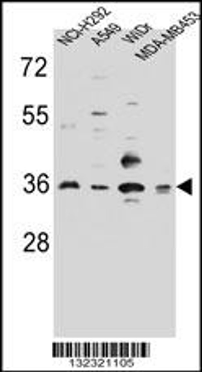 Western blot analysis in NCI-H292, A549, WiDr, MDA-MB453 cell line lysates (35ug/lane) .