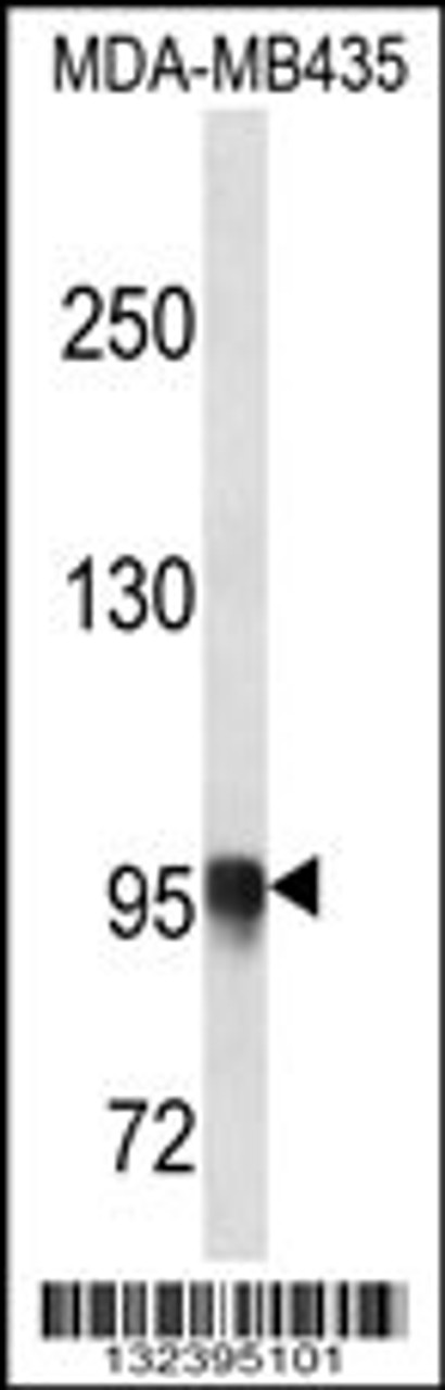 Western blot analysis in MDA-MB435 cell line lysates (35ug/lane) .