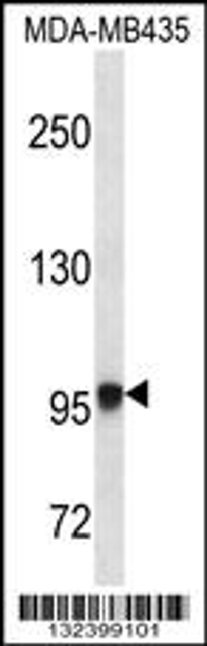 Western blot analysis in MDA-MB435 cell line lysates (35ug/lane) .