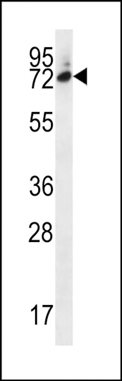 Western blot analysis in MDA-MB231 cell line lysates (35ug/lane) .