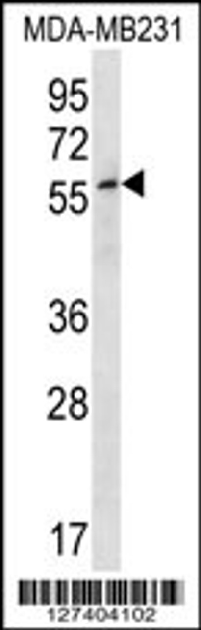 Western blot analysis in MDA-MB231 cell line lysates (35ug/lane) .