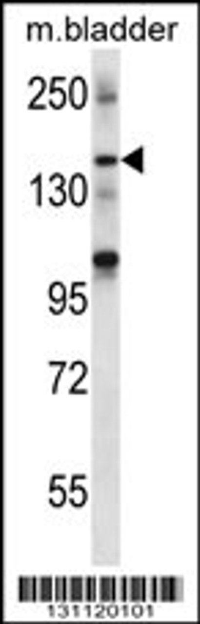 Western blot analysis in mouse bladder tissue lysates (35ug/lane) .