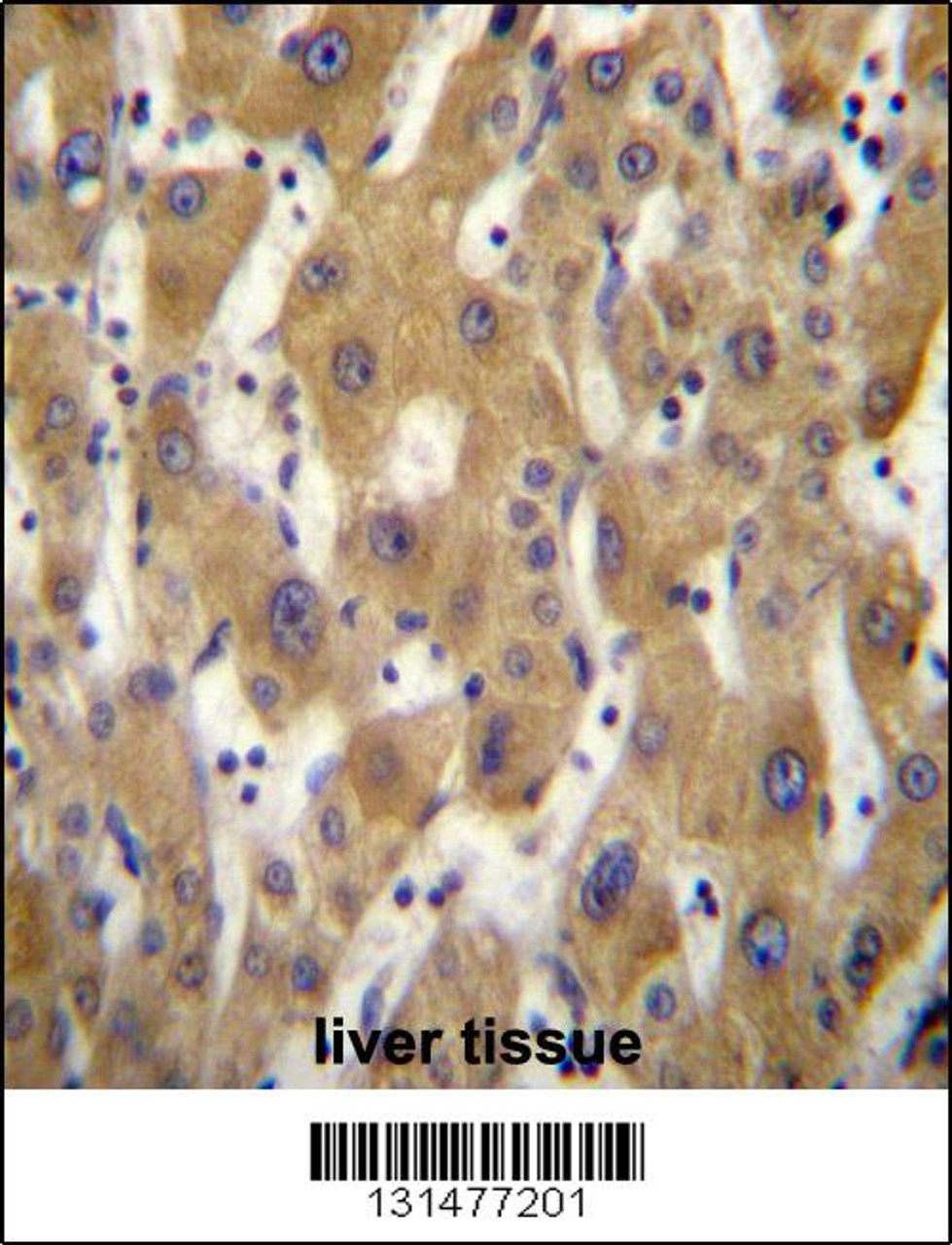 PAGE5 Antibody immunohistochemistry analysis in formalin fixed and paraffin embedded human liver tissue followed by peroxidase conjugation of the secondary antibody and DAB staining.