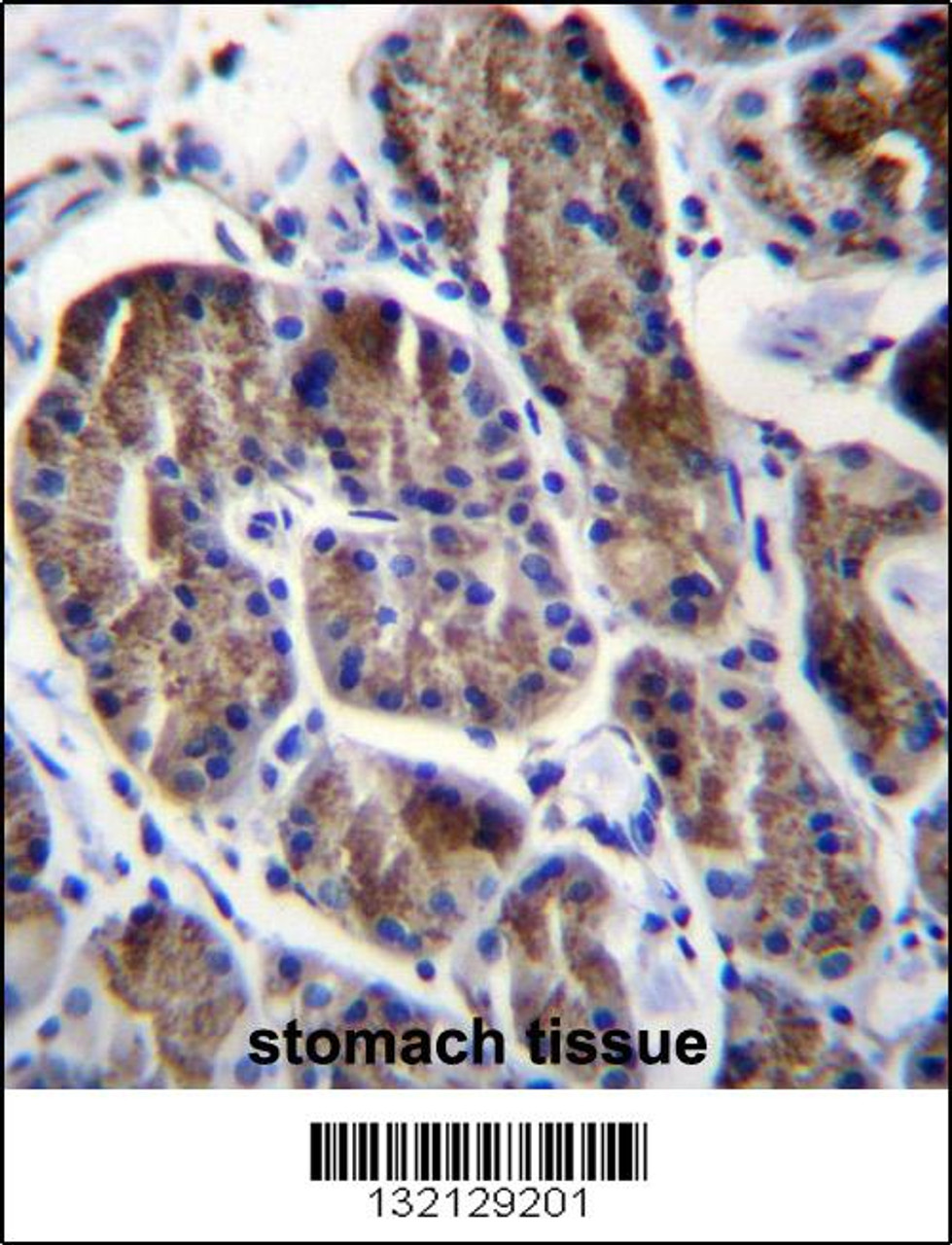 RPS4Y1 Antibody immunohistochemistry analysis in formalin fixed and paraffin embedded human stomach tissue followed by peroxidase conjugation of the secondary antibody and DAB staining.