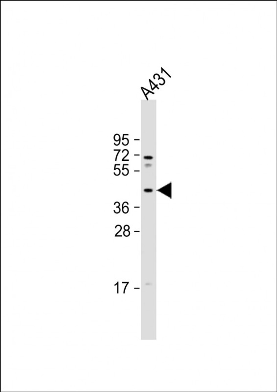 Western Blot at 1:1000 dilution + A431 whole cell lysate Lysates/proteins at 20 ug per lane.