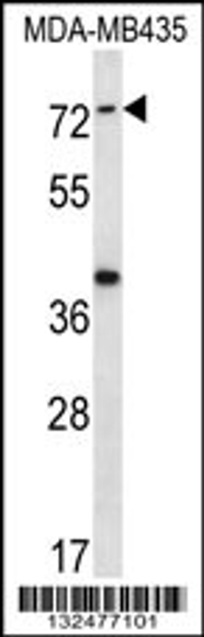 Western blot analysis in MDA-MB435 cell line lysates (35ug/lane) .