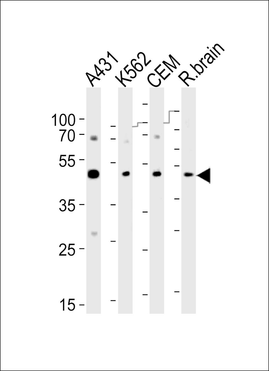 Western blot analysis of lysates from A431, K562, CEM cell line and rat brain tissue lyaste (from left to right) , using SUV39H2 Antibody (K315) at 1:1000 at each lane.