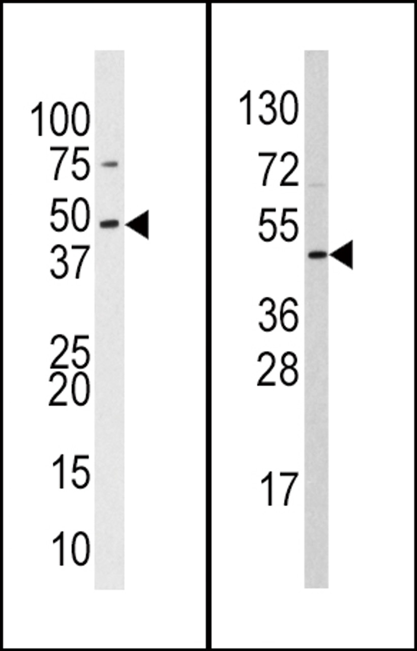 Western blot analysis of anti-hSUV39H2-K315 Pab (Cat. AP1281b) in 293 and HL60 cell line lysates (35ug/lane) .