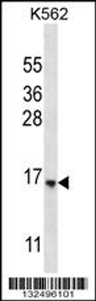 Western blot analysis in K562 cell line lysates (35ug/lane) .