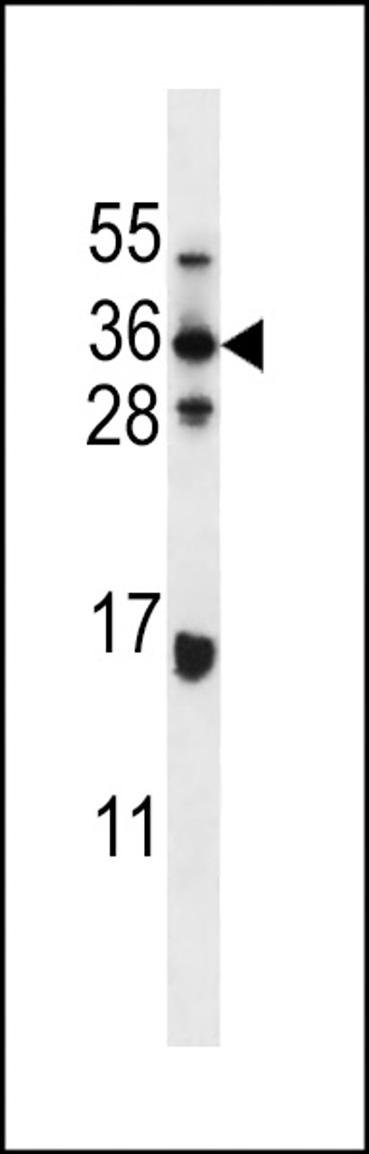 Western blot analysis in MDA-MB435 cell line lysates (35ug/lane) .