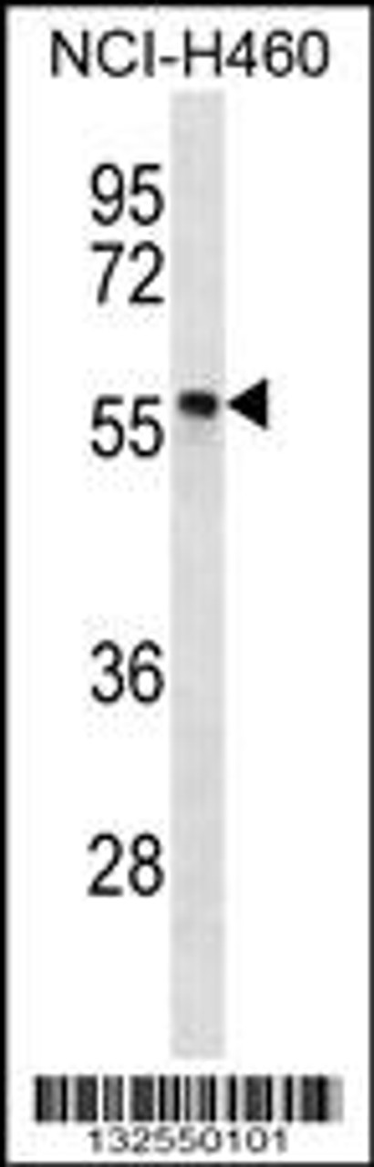 Western blot analysis in NCI-H460 cell line lysates (35ug/lane) .