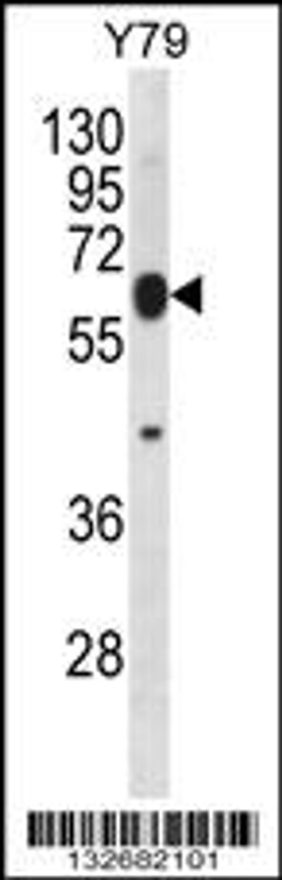 Western blot analysis in Y79 cell line lysates (35ug/lane) .