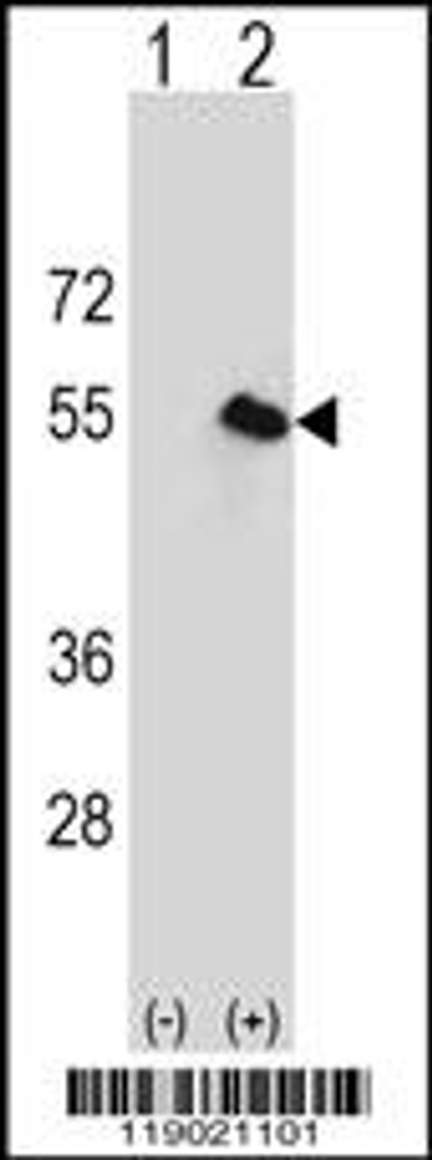 Western blot analysis of CPN1 using rabbit polyclonal CPN1 Antibody using 293 cell lysates (2 ug/lane) either nontransfected (Lane 1) or transiently transfected (Lane 2) with the CPN1 gene.