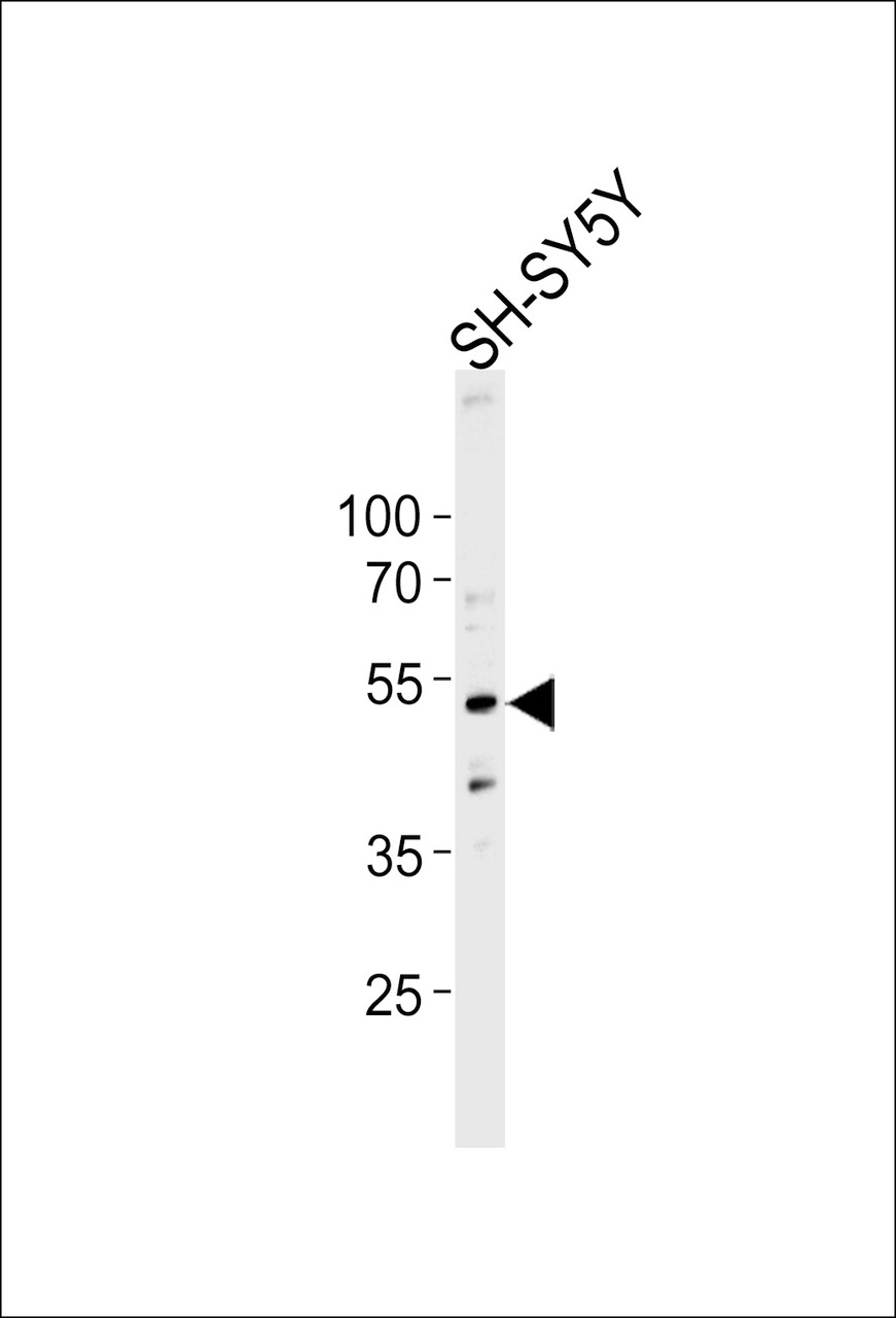 Western blot analysis of lysate from SH-SY5Y cell line, using DCTN2 Antibody at 1:1000 at each lane.