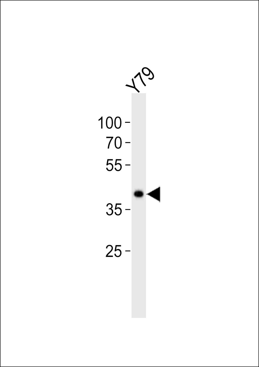 Western blot analysis of lysate from Y79 cell line, using EIF3H Antibody at 1:1000.