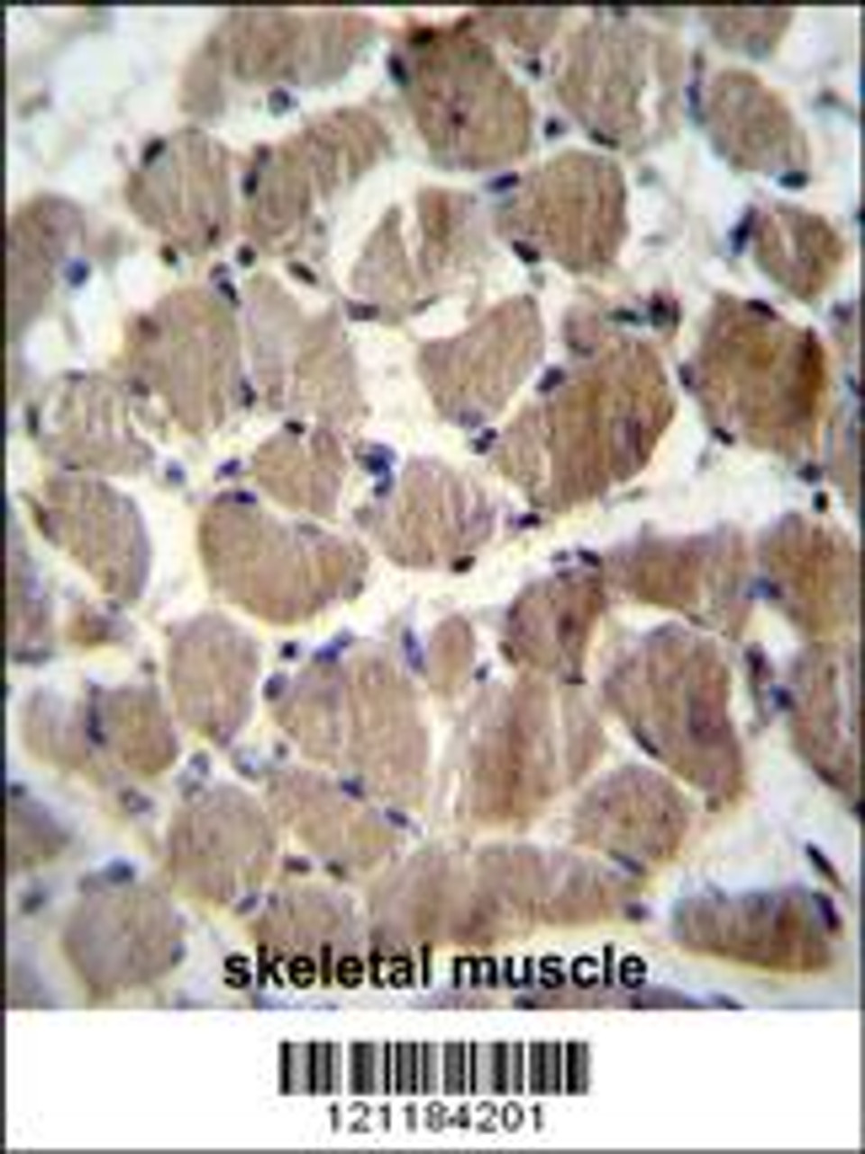 COCH Antibody immunohistochemistry analysis in formalin fixed and paraffin embedded human skeletal muscle followed by peroxidase conjugation of the secondary antibody and DAB staining.