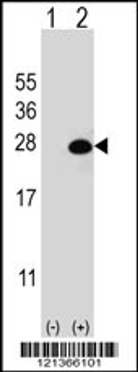 Western blot analysis of DGCR6L using rabbit polyclonal DGCR6L Antibody using 293 cell lysates (2 ug/lane) either nontransfected (Lane 1) or transiently transfected (Lane 2) with the DGCR6L gene.