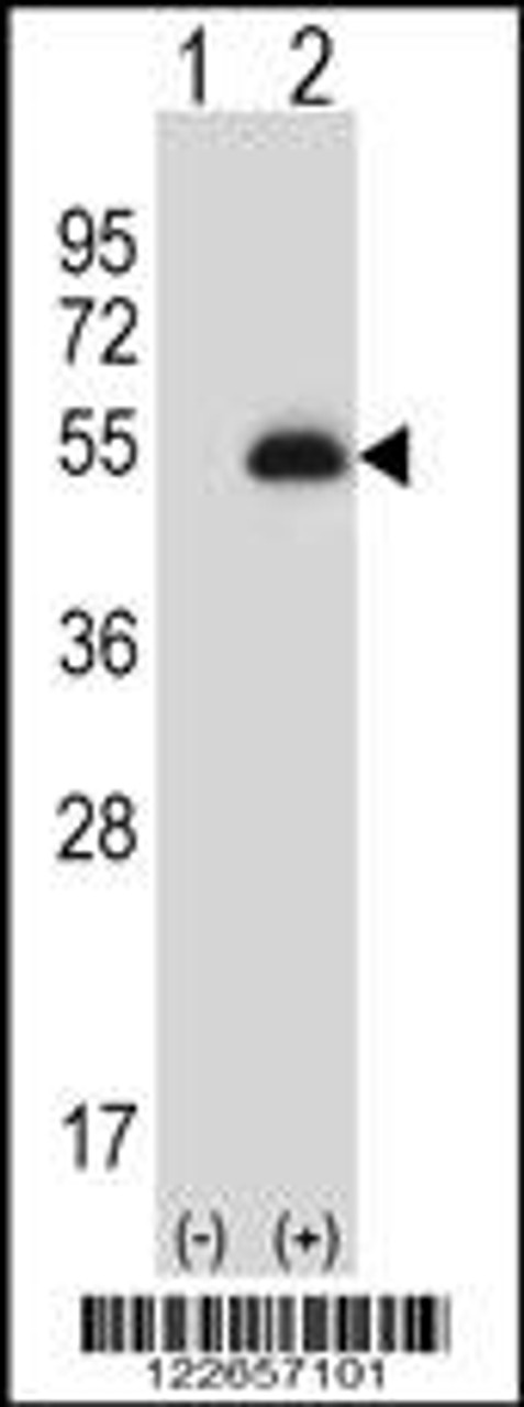 Western blot analysis of PAX6 using rabbit polyclonal PAX6 Antibody using 293 cell lysates (2 ug/lane) either nontransfected (Lane 1) or transiently transfected (Lane 2) with the PAX6 gene.