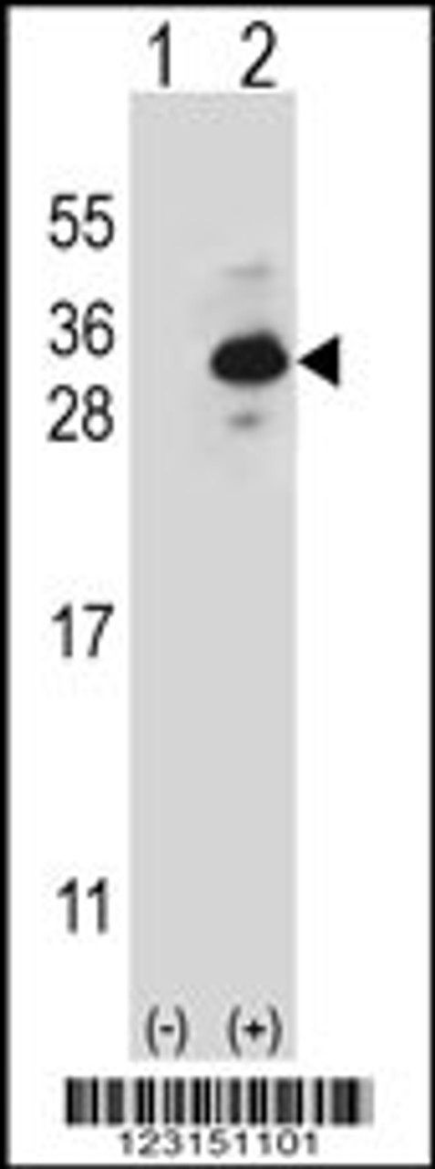 Western blot analysis of CLTB using rabbit polyclonal CLTB Antibody using 293 cell lysates (2 ug/lane) either nontransfected (Lane 1) or transiently transfected (Lane 2) with the CLTB gene.