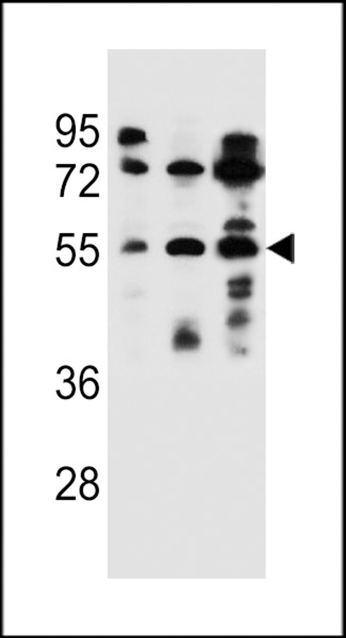 Western blot analysis in ZR-75-1, NCI-H292, 293 cell line lysates (35ug/lane) .