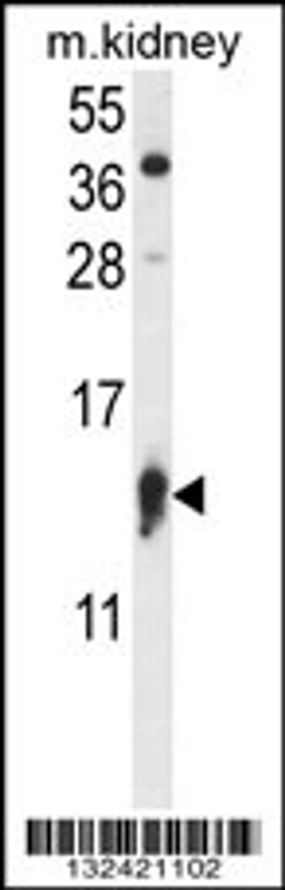 Western blot analysis in mouse kidney tissue lysates (35ug/lane) .