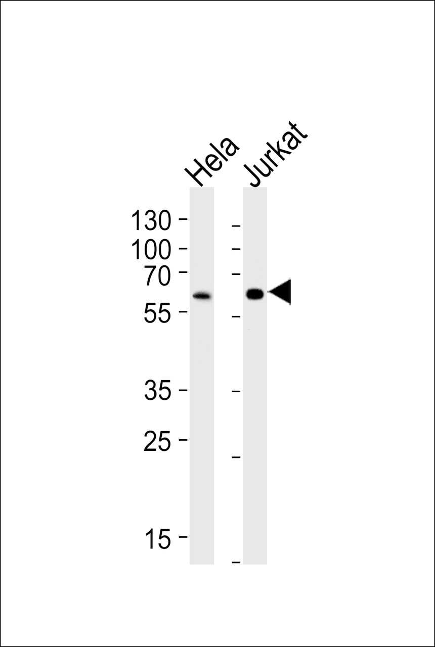 Western blot analysis of lysates from HeLa, Jurkat cell line (from left to right) , using HPSE2 Antibody at 1:1000 at each lane.