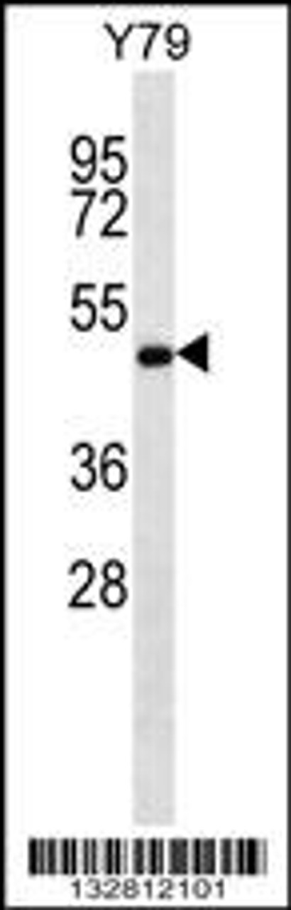 Western blot analysis in Y79 cell line lysates (35ug/lane) .