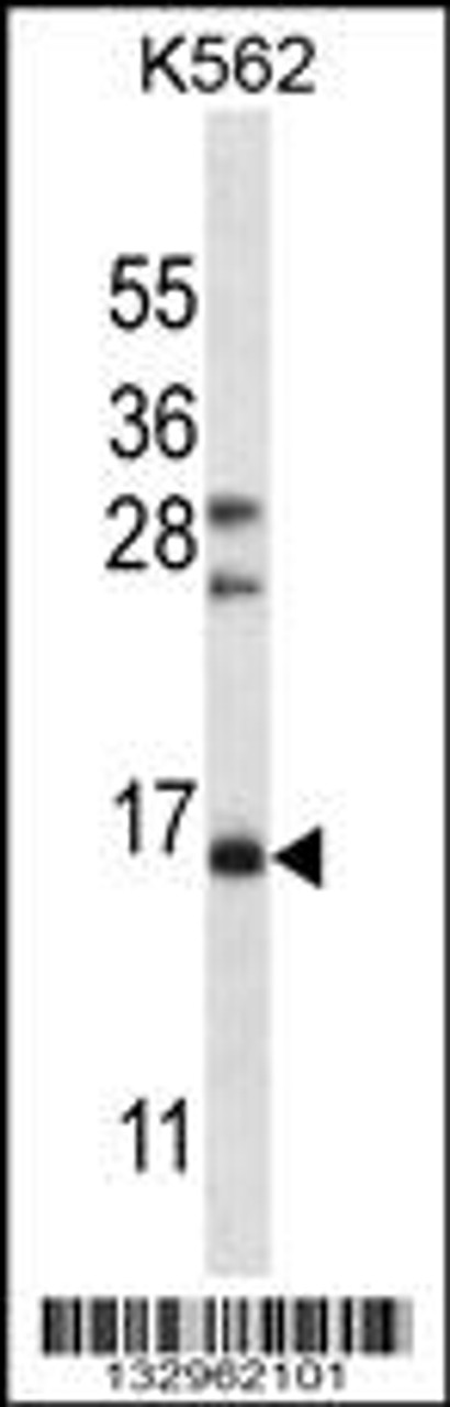 Western blot analysis in K562 cell line lysates (35ug/lane) .