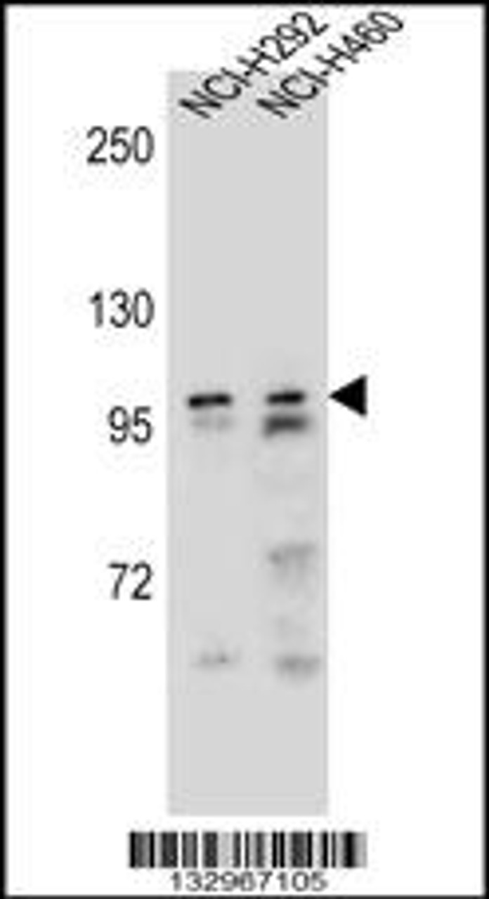 Western blot analysis in NCI-H292, NCI-H460 cell line lysates (35ug/lane) .This demonstrates the detected the AR protein (arrow) .
