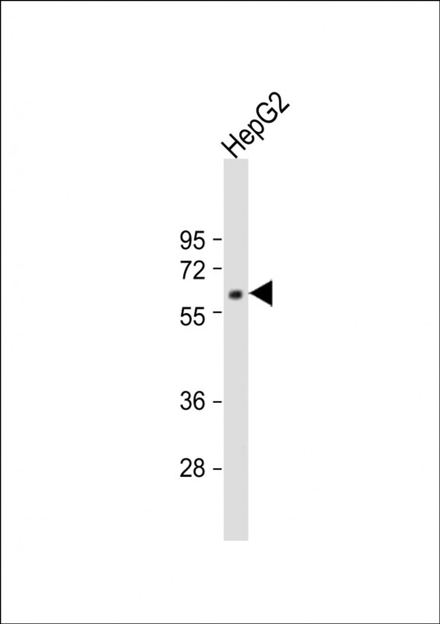 Western Blot at 1:1000 dilution + HepG2 whole cell lysate Lysates/proteins at 20 ug per lane.